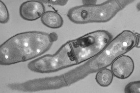 Morita lab investigates the molecular mechanisms of mycobacterial pathogenesis