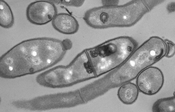 Morita lab investigates the molecular mechanisms of mycobacterial pathogenesis Morita lab investigates the molecular mechanisms of mycobacterial pathogenesis