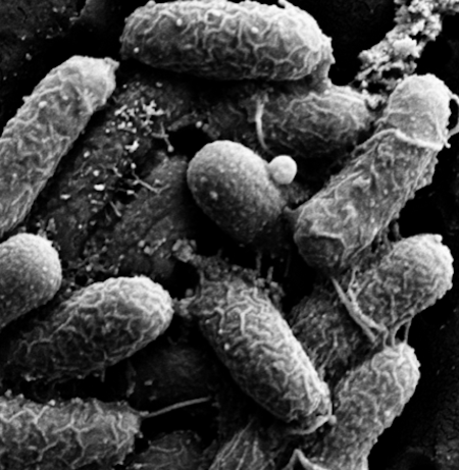 Vibrio cholerae, the bacterium that causes cholera, as seen under an electron microscope after being exposed to an antibody